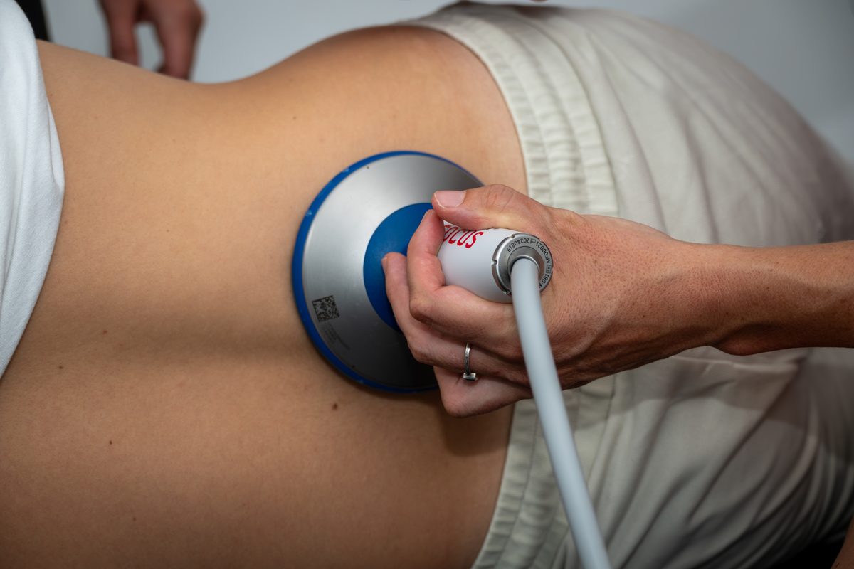 A focused shockwave applicator on a patient’s back
